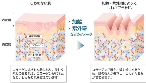 『シワ』のメカニズムと予防方法