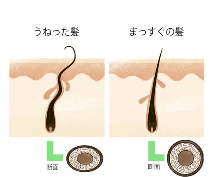 髪の毛の うねり について